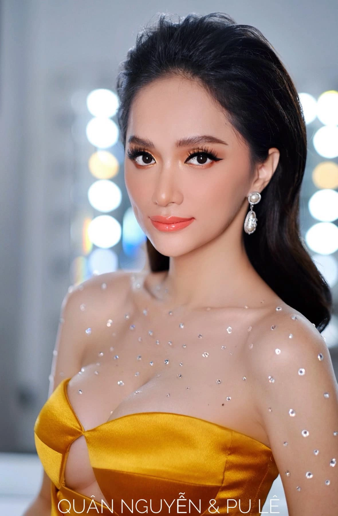 Nâng ngực dành cho người chuyển giới chuyên gia lưu ý để ngực vào form tự nhiên - 3