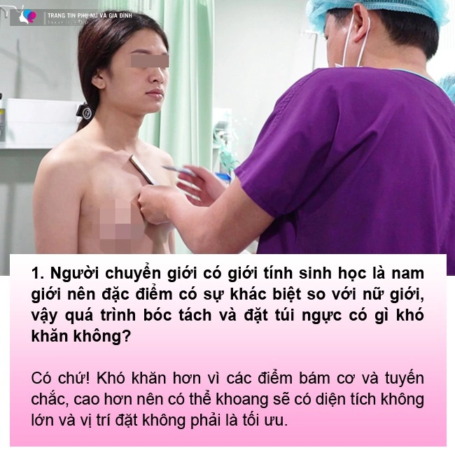 Nâng ngực dành cho người chuyển giới chuyên gia lưu ý để ngực vào form tự nhiên - 6