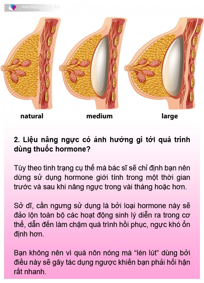 Nâng ngực dành cho người chuyển giới chuyên gia lưu ý để ngực vào form tự nhiên - 7