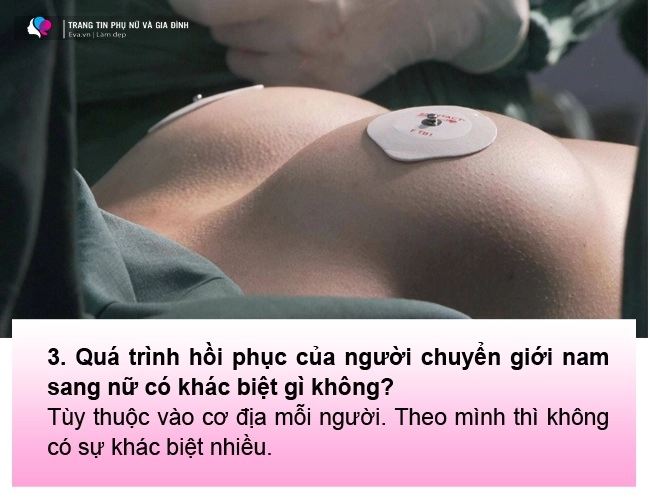 Nâng ngực dành cho người chuyển giới chuyên gia lưu ý để ngực vào form tự nhiên - 8