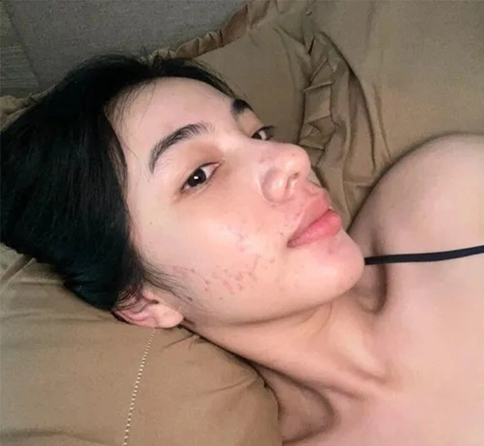 Ngày nào cẩm đan banh mặt vì mụn giờ là mỹ nhân mặt mộc nhờ sửa sai đúng 1 điều - 5
