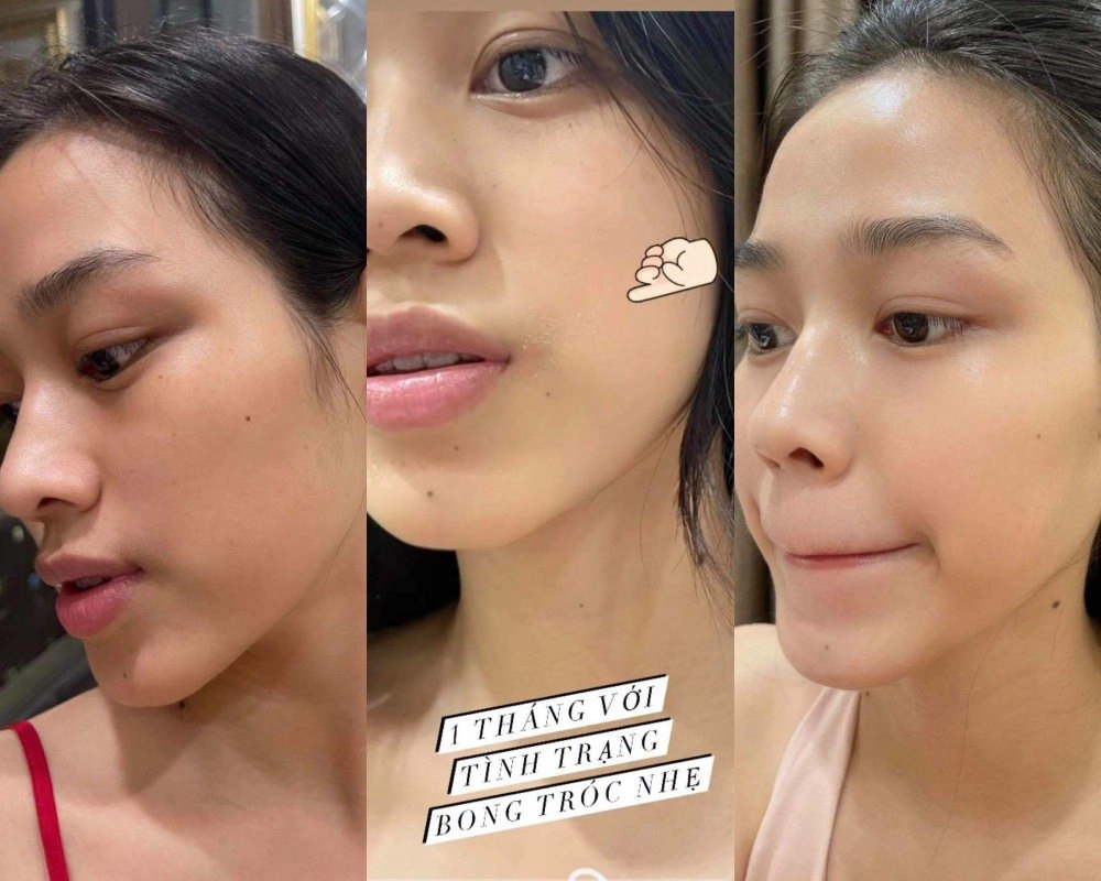 Nghe beauty blogger kể chuyện dùng retinoltretinoin chị em vơi bớt nỗi sợ nát mặt - 2