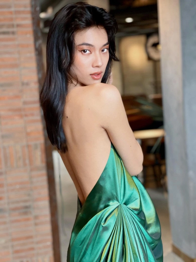Người mẫu lưỡng tính kể chuyện đi nâng ngực tôi mê man không biết gì suốt 3 tiếng - 8