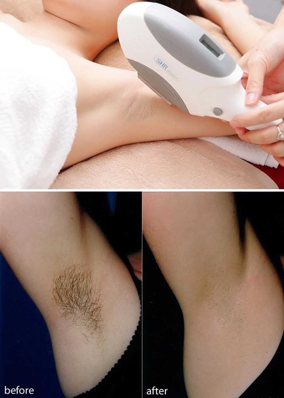 Người nổi tiếng làm gì để vùng da dưới cánh tay luôn trắng mịn đến thế - 5