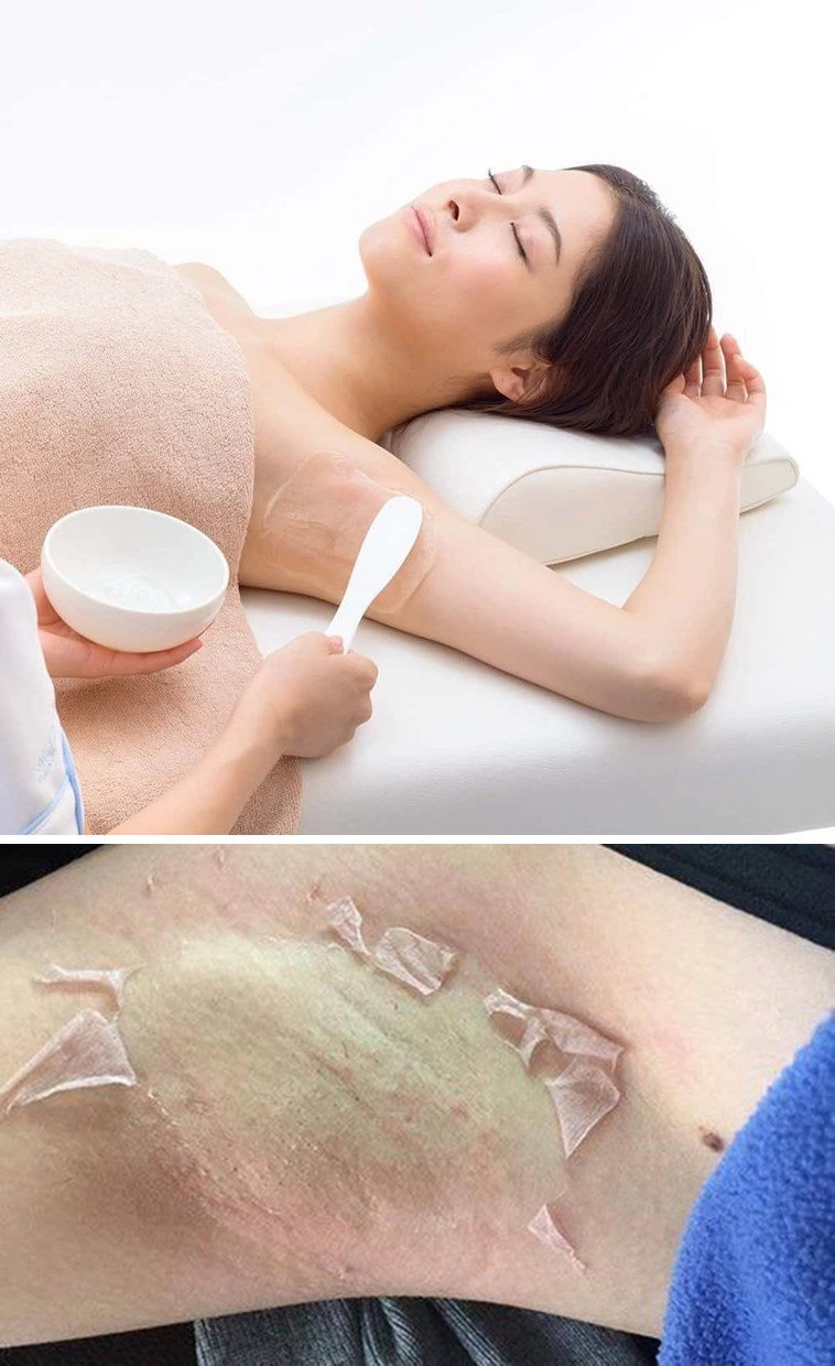 Người nổi tiếng làm gì để vùng da dưới cánh tay luôn trắng mịn đến thế - 7