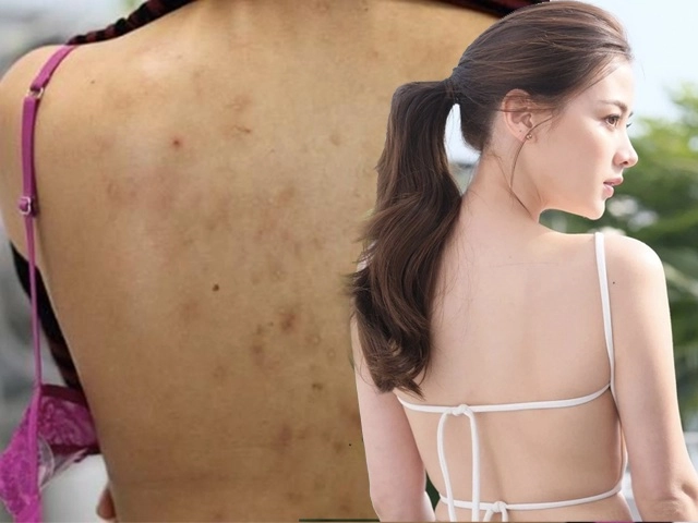 Người nổi tiếng làm gì để vùng da dưới cánh tay luôn trắng mịn đến thế - 9