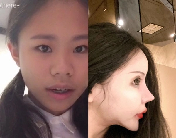 Người phụ nữ trẻ đẹp bỗng hoá phù thuỷ vì thẩm mỹ quá tay - 2