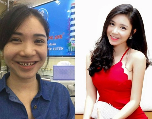 người tình thiếu gia phan hải khoe nhan sắc khác lạ hậu thẩm mỹ nụ cười rùng rợn - 3