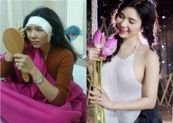 người tình thiếu gia phan hải khoe nhan sắc khác lạ hậu thẩm mỹ nụ cười rùng rợn - 4