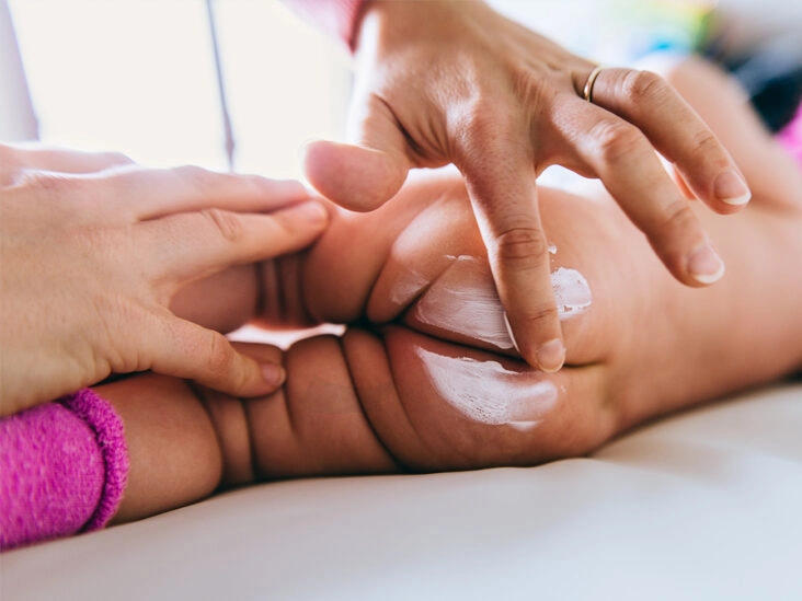 Nguyên nhân trẻ sơ sinh bị hăm đỏ hậu môn - 3