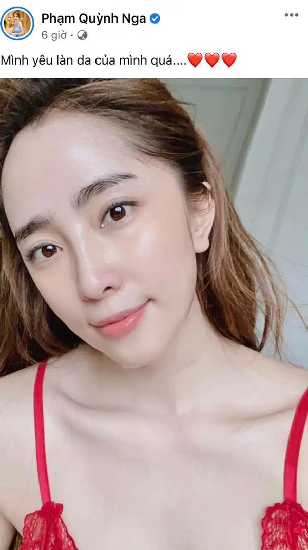 Nhan sắc nở rộ sau thẩm mỹ quỳnh nga được khen ngợi hết lời - 5