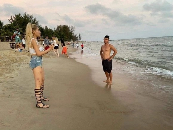 Nhan sắc thật của lương bằng quang trước khi đập đi xây lại ra sao mà ngân 98 phải sợ - 2