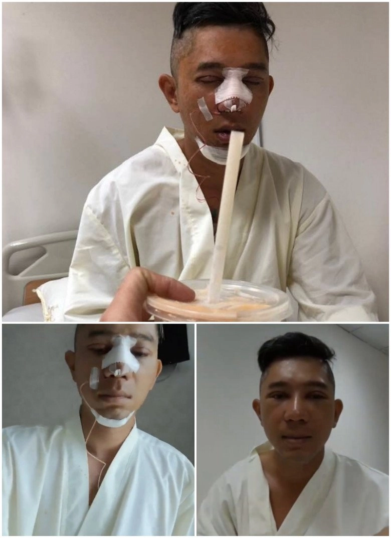 Nhan sắc thật của lương bằng quang trước khi đập đi xây lại ra sao mà ngân 98 phải sợ - 8