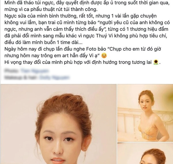 Nhiều sao nữ tháo túi độn ngực trở về với vẻ đẹp tự nhiên nguyên nhân vì đâu - 5