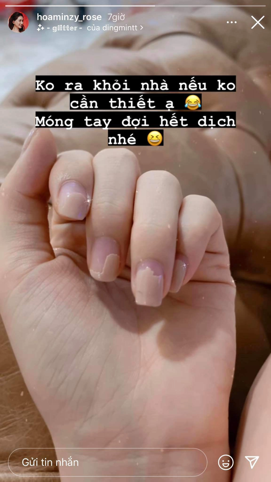 Nhìn móng tay hoà minzy cụt lủn bong tróc thấy thương nhưng lí do ai nấy đều đồng cảm - 3