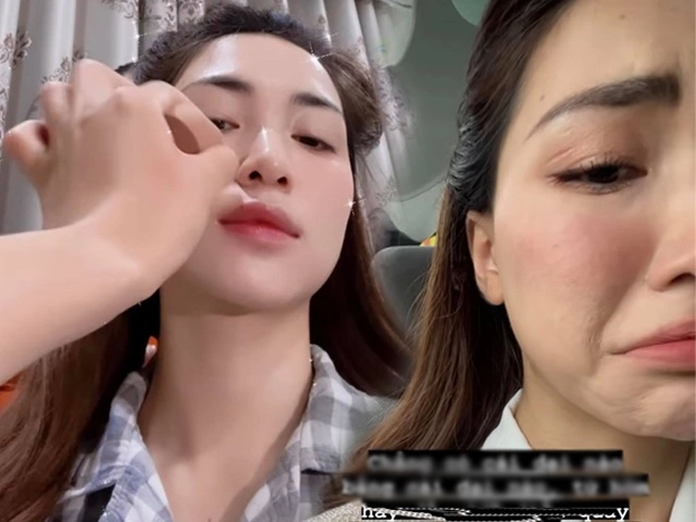 Nhìn móng tay hoà minzy cụt lủn bong tróc thấy thương nhưng lí do ai nấy đều đồng cảm - 14