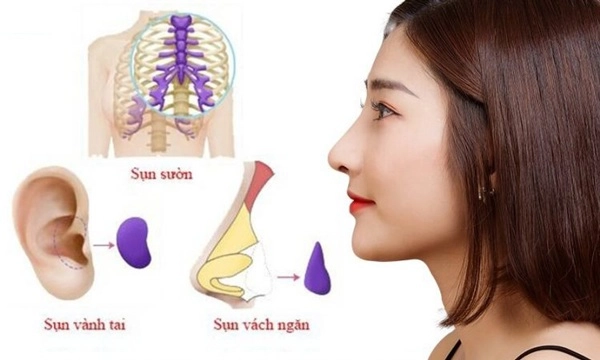 Nhung bo phan de bi nhìn nham là phau thuat tham my nhat trên guong mat sao việt - 19