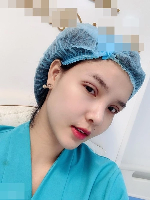 Những chiếc mí mắt sưng phù hậu dao kéo làm sao việt hoang mang - 6