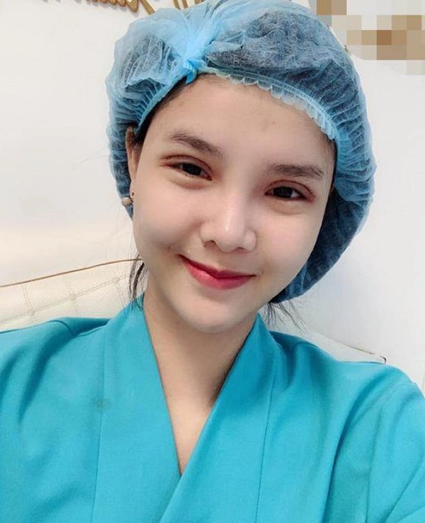 Những chiếc mí mắt sưng phù hậu dao kéo làm sao việt hoang mang - 7