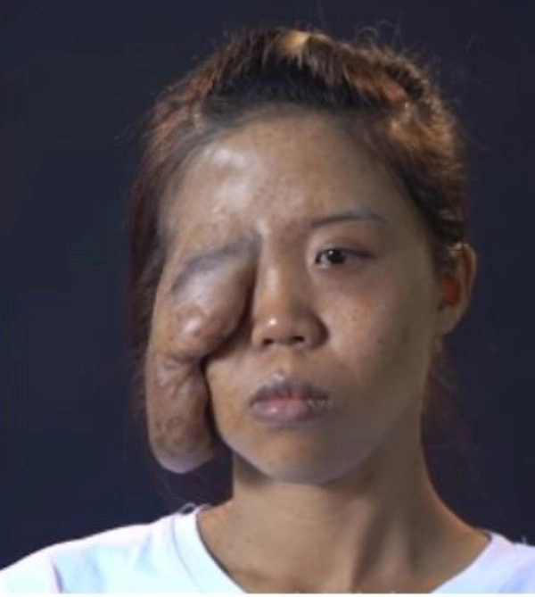 Nhung nguoi phu nu mang mat quy hoa thien than nho phau thuat tham my - 2