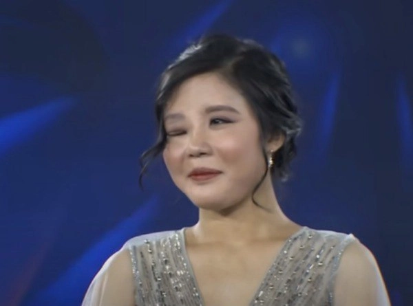 Nhung nguoi phu nu mang mat quy hoa thien than nho phau thuat tham my - 3