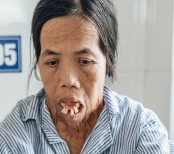 Nhung nguoi phu nu mang mat quy hoa thien than nho phau thuat tham my - 4