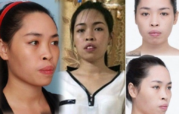 Nhung nguoi phu nu mang mat quy hoa thien than nho phau thuat tham my - 10