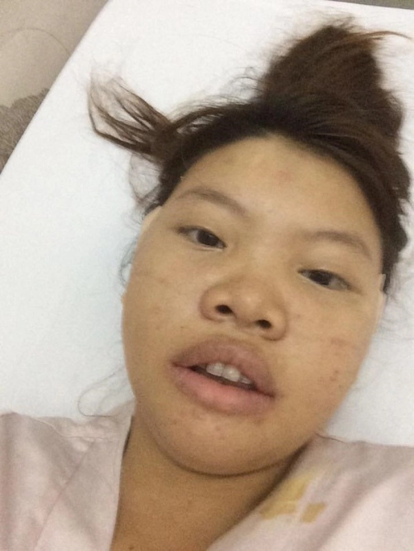 Nhung nguoi phu nu mang mat quy hoa thien than nho phau thuat tham my - 12