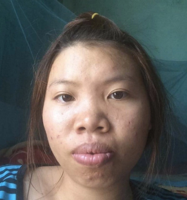 Nhung nguoi phu nu mang mat quy hoa thien than nho phau thuat tham my - 13