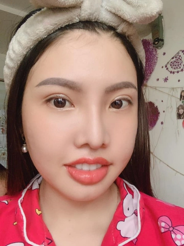 Nhung nguoi phu nu mang mat quy hoa thien than nho phau thuat tham my - 14