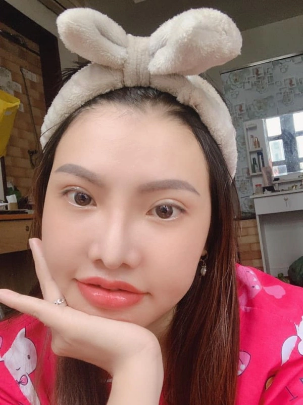 Nhung nguoi phu nu mang mat quy hoa thien than nho phau thuat tham my - 15
