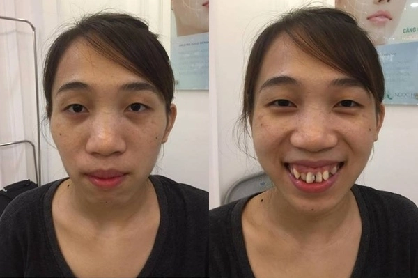 Nhung nguoi phu nu mang mat quy hoa thien than nho phau thuat tham my - 17