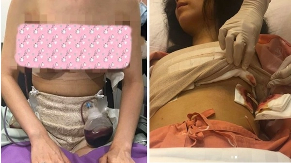 Những pha nâng ngực không thành làm các nàng thêm chùn bước - 3