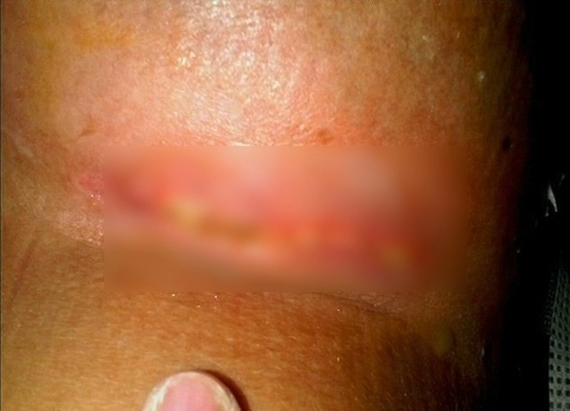 Những pha nâng ngực không thành làm các nàng thêm chùn bước - 7