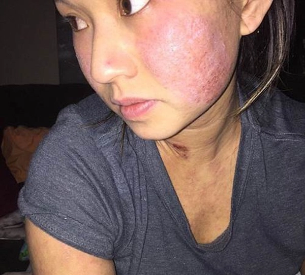 Những pha nâng ngực không thành làm các nàng thêm chùn bước - 10