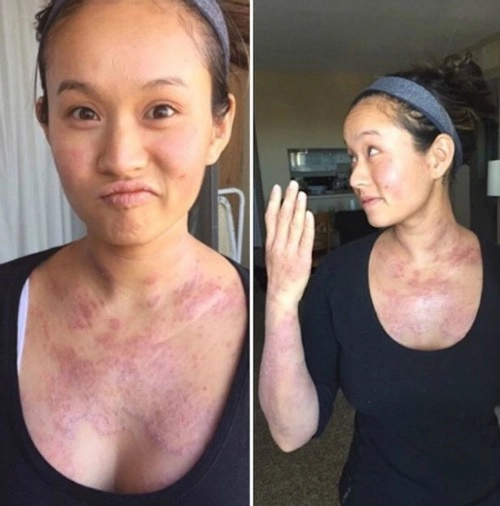 Những pha nâng ngực không thành làm các nàng thêm chùn bước - 11