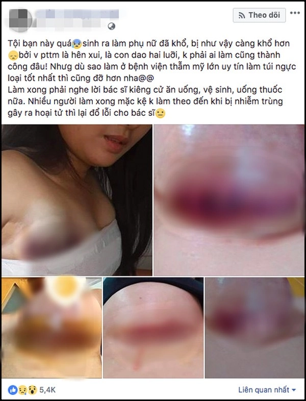 Những pha nâng ngực không thành làm các nàng thêm chùn bước - 12
