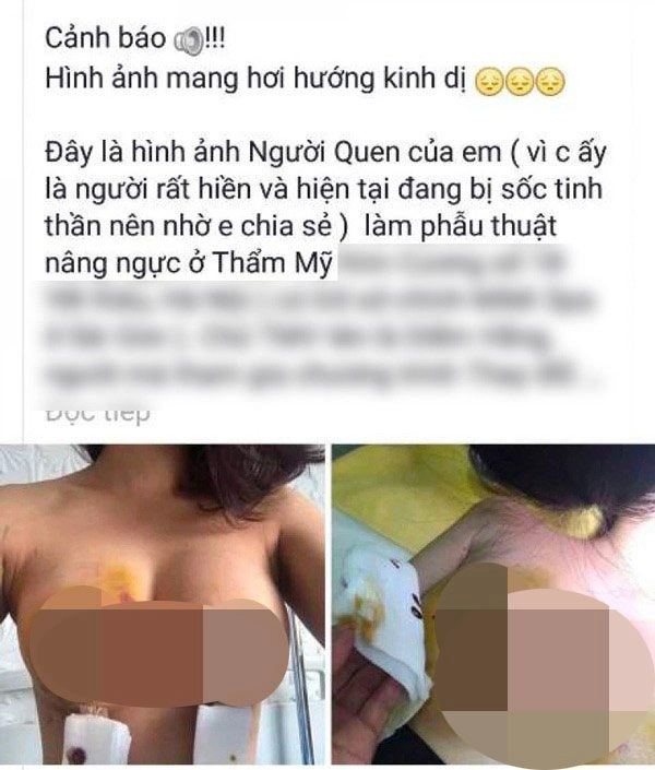 Những pha nâng ngực không thành làm các nàng thêm chùn bước - 13