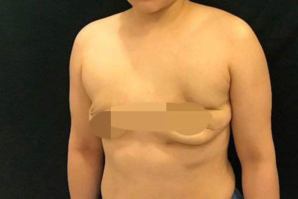 Những pha nâng ngực không thành làm các nàng thêm chùn bước - 14