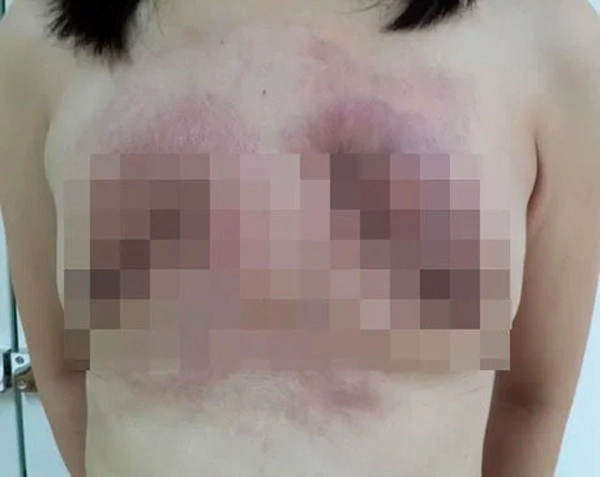 Những pha nâng ngực không thành làm các nàng thêm chùn bước - 15