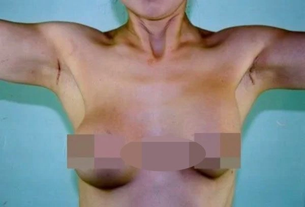 Những pha nâng ngực không thành làm các nàng thêm chùn bước - 16