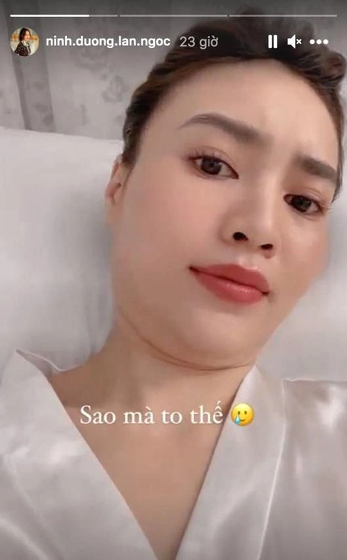 Nọng cằm - nỗi ám ảnh của sao việt và những thói quen gây tích mỡ ai cũng mắc - 2