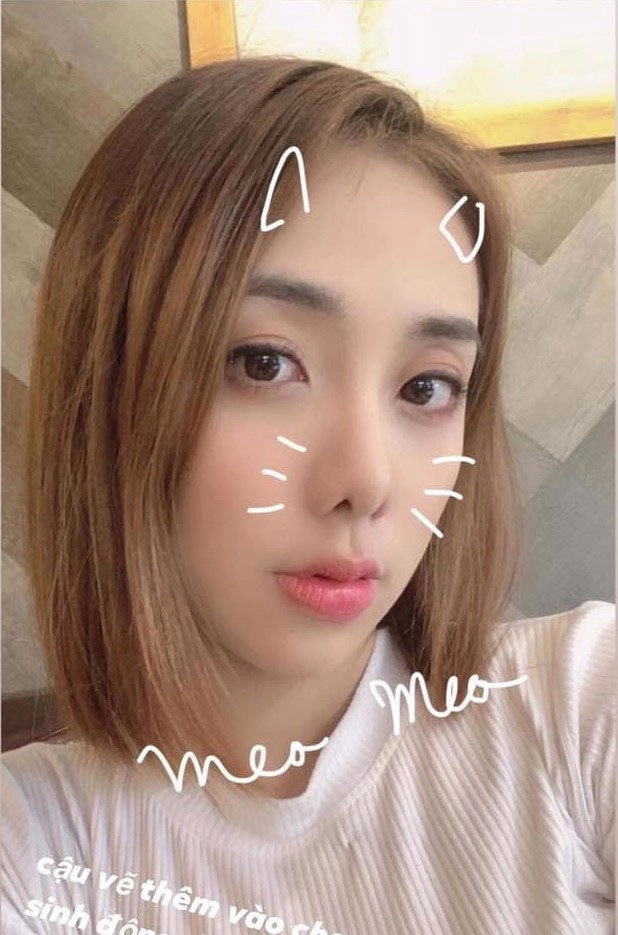 Nữ ca sĩ tin pttm thay đổi phong thuỷ và đây là cái kết sau khi hút mỡ tạo cơ - 19