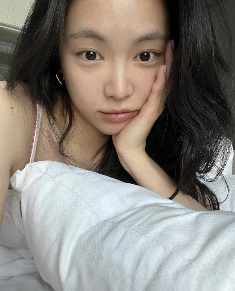 Nữ thần hàn quốc 1 thời bị nói mặt mất tự nhiên vì lạm dụng thẩm mỹ dáng vẫn bốc lửa miễn chê - 1