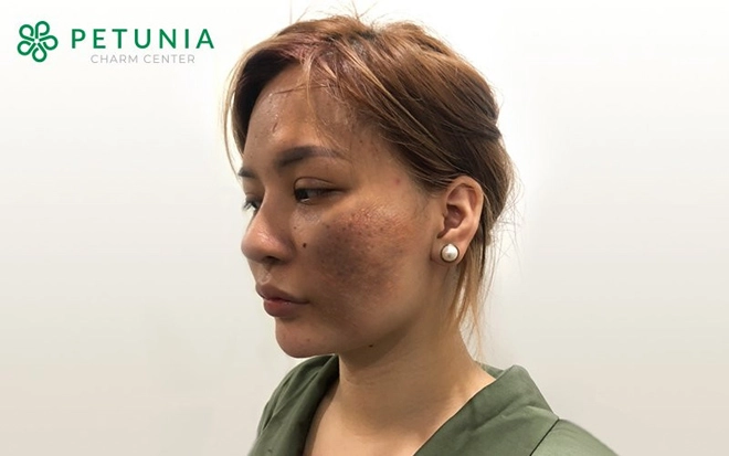 Petunia charm center - những khác biệt của hệ thống làm đẹp ứng dụng công nghệ sinh học - 1