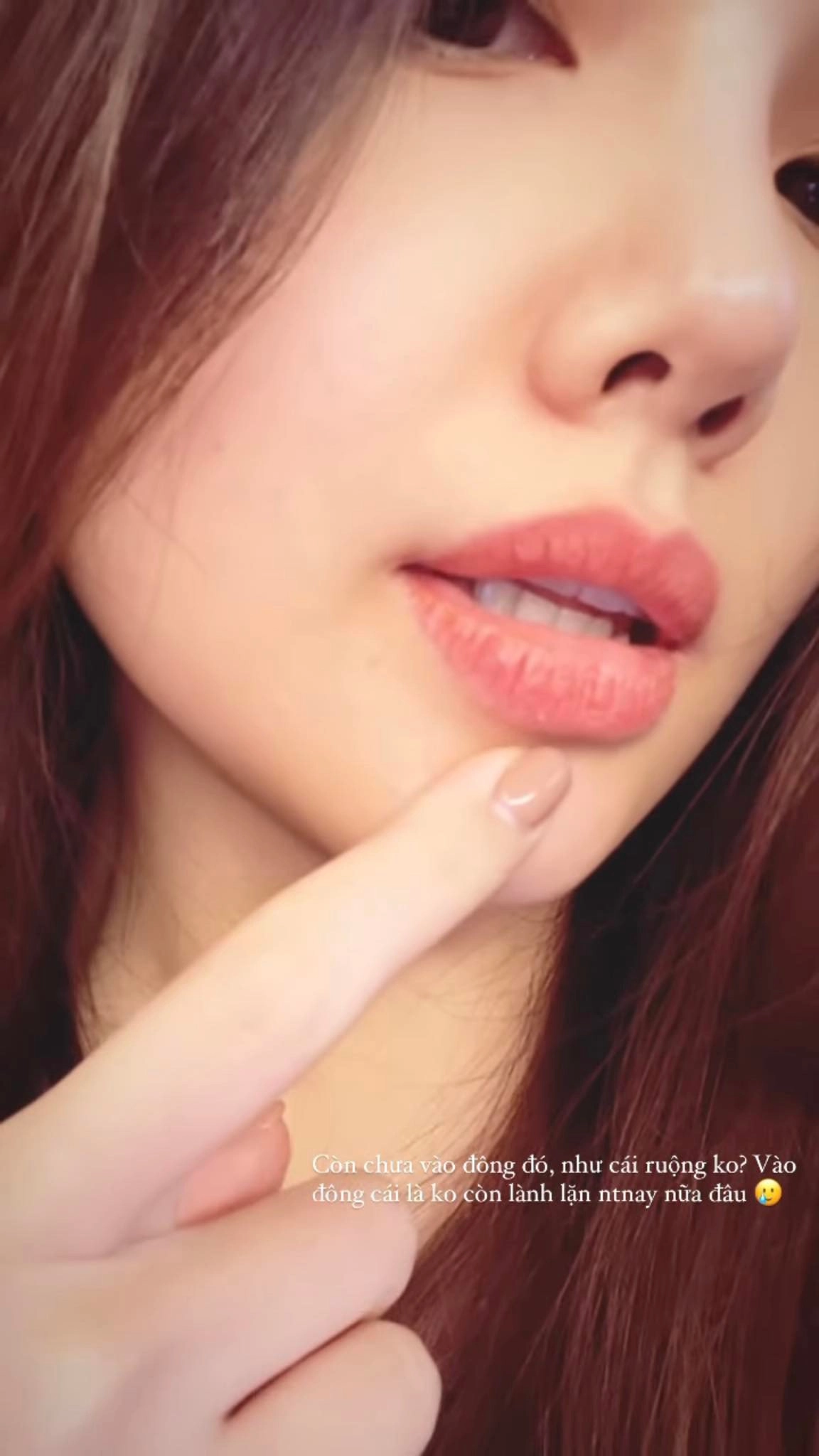 Phanh lee sau sinh xinh đẹp không mùi bỉm sữa vẫn đòi đi tiêm chích để sửa lỗi nhan sắc - 4