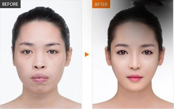Phau thuat gan het khuôn mat các hotgirl mang xã hoi ngày ấy giờ thế nào - 1