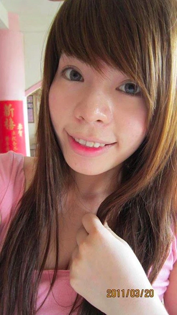 Phau thuat gan het khuôn mat các hotgirl mang xã hoi ngày ấy giờ thế nào - 7