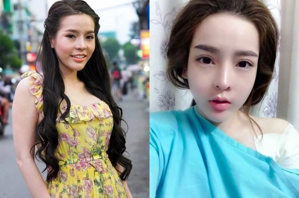 Phau thuat gan het khuôn mat các hotgirl mang xã hoi ngày ấy giờ thế nào - 8