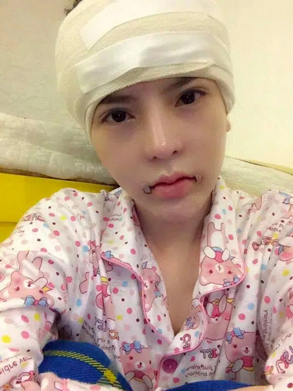 Phau thuat gan het khuôn mat các hotgirl mang xã hoi ngày ấy giờ thế nào - 9